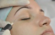 Carboxiterapia Facial