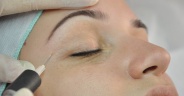 Carboxiterapia Facial
