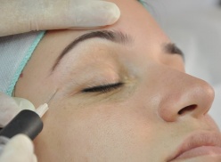 Carboxiterapia Facial