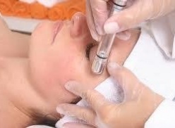 Peeling de Diamante Peeling de Diamante