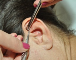 Auticular