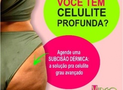 Subcisão dérmica Subcisão dérmica