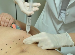 Intradermoterapia Intradermoterapia
