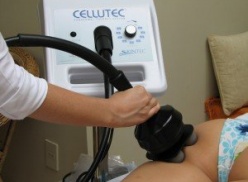 Cellutec Cellutec