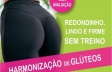 Harmonização de Glúteo